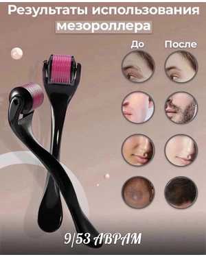 Мезороллер для лица и тела от морщин косметологический уход 1мм