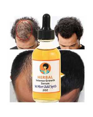 MOOYAM hair growth essential oil Эфирное масло для восстановления и роста волос, 20 мл