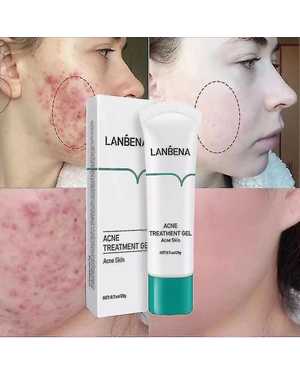 LANBENA ACNE TREATMENT GEL 20 g - крем - гель эффективно вылечит угревую сыпь и прыщи, поможет устранить повреждения кожи