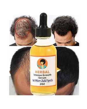 MOOYAM hair growth essential oil Эфирное масло для восстановления и роста волос, 20 мл