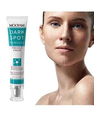 отбеливающий крем для удаления веснушек